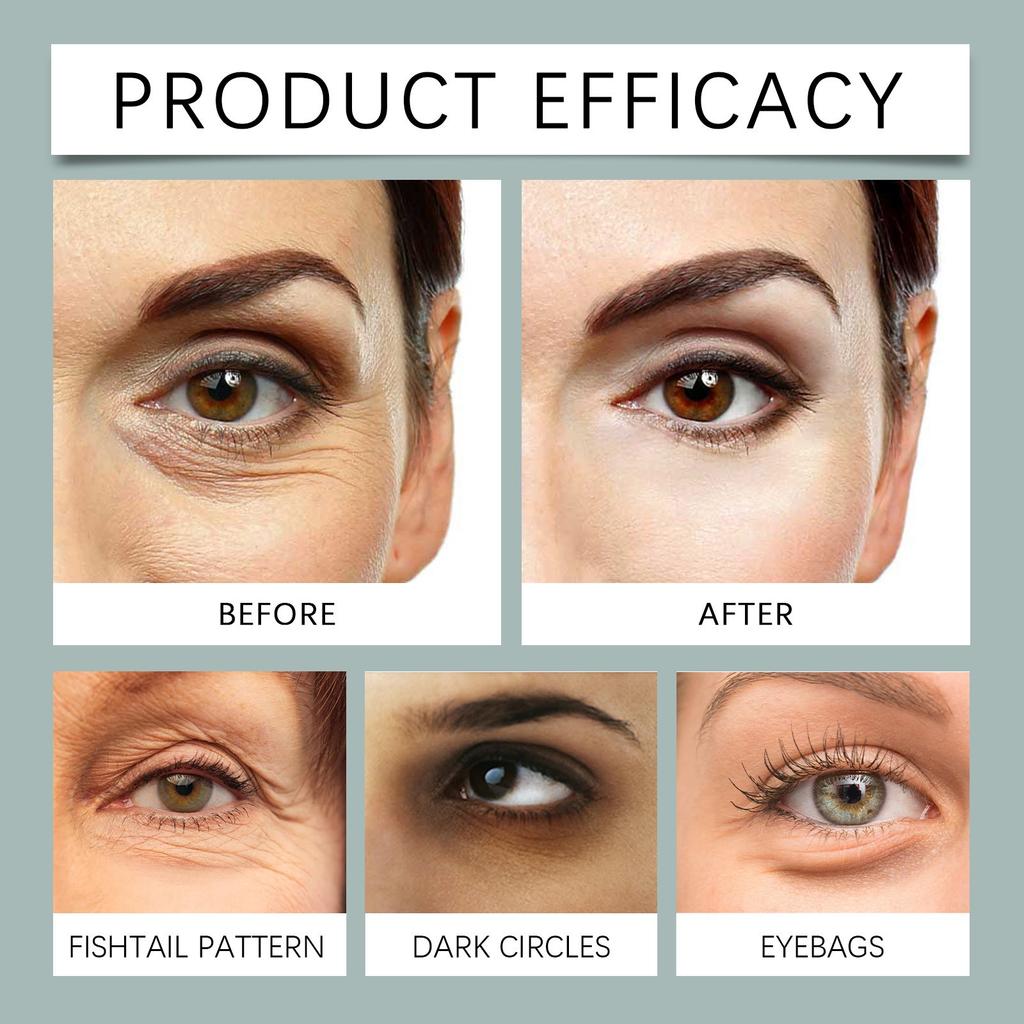 Гиалуроновая маска-патч для глаз, увлажняющая, осветляющая, от морщин, «гусиных лапок», удаляющая темные круги, увлажняющая маска-патч для глаз, 1 пара, 3 мл