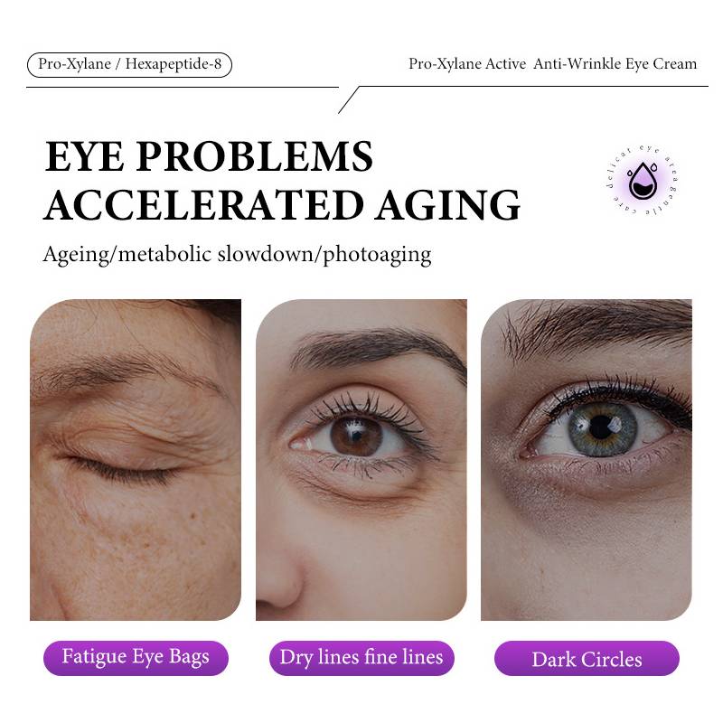 Активирующий увлажняющий крем для глаз 20 г Уменьшает мелкие морщинки и темные круги вокруг глаз