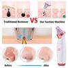 Blackhead Remover Blackhead Suction Equipment Electric Blackhead Suction Pore Cleaner Beauty Equipment White