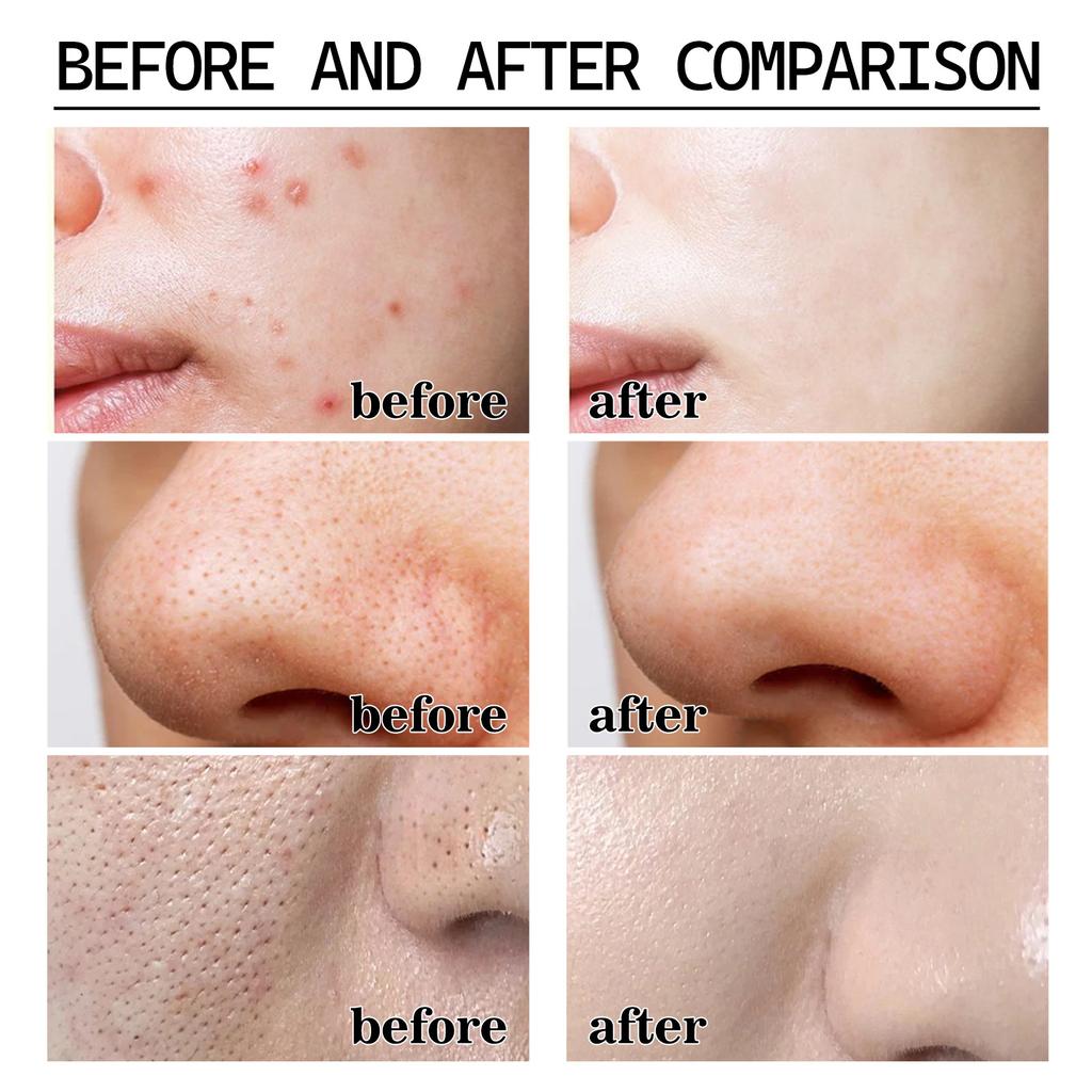 EELHOE Маска для удаления черных точек с маслом чайного дерева, черная отшелушивающая маска для лица, грязь, глубокая очистка, сужение пор, уход за кожей против прыщей, 50 г