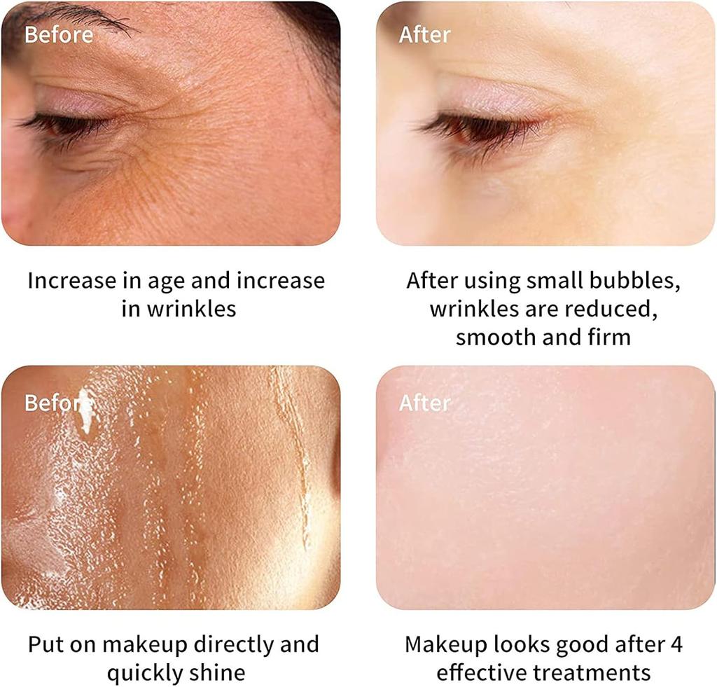 8 In 1 Multifunctional Hydrogen Oxygen Bubble Facial Beauty Machine Face Skin Rejuvenation Moisturizing Anti Wrinkle Anti Aging