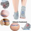 Arura Heel Socks Anti Crack Heel Protector Socks Heel Pain Relief Socks Silicone Gel Heel Socks For Men And Women