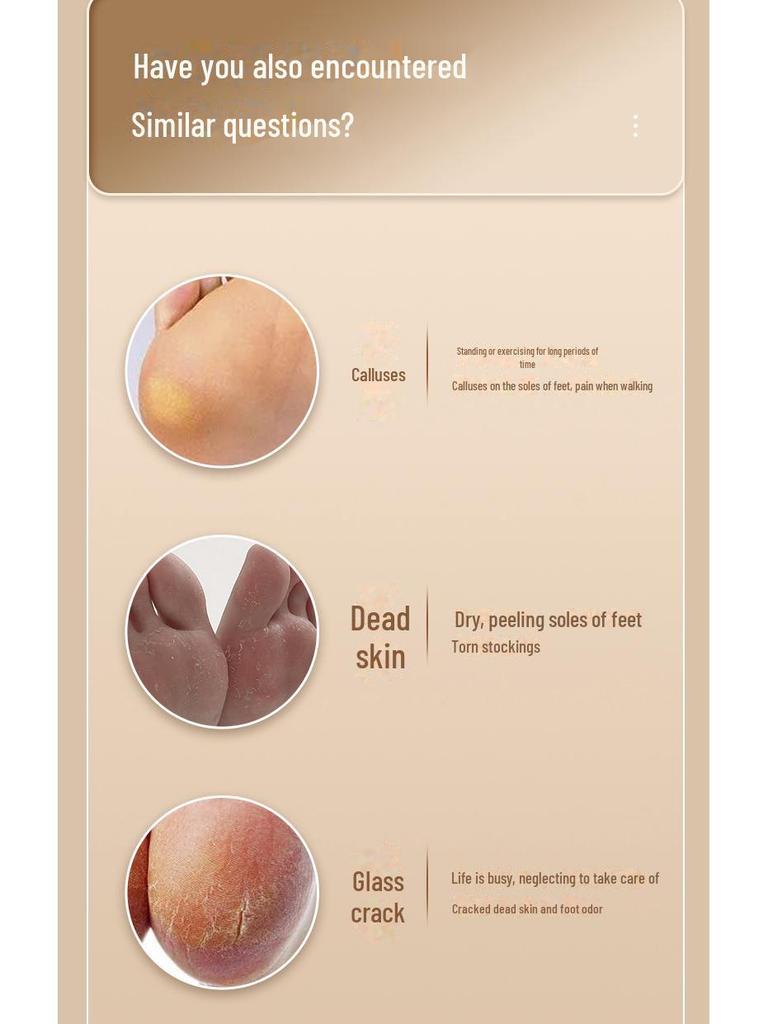 2024 Электрический станок для шлифовки ног: USB-перезаряжаемый педикюрный прибор для легкого пилинга и удаления мозолей