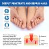 10Pcs Nail Correction Stickers Ingrown Toenail Onychomycosis Repair Patch Paronychia Treatment Recover Corrector Pedicure Tools