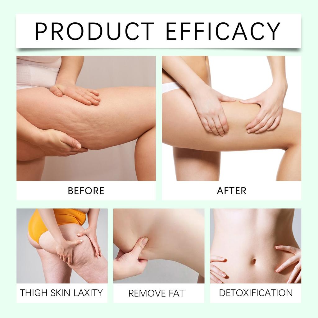 Травяной крем для здоровья тела, Успокаивающий крем для тела, Облегчающий уход за телом, Мягкий питательный восстанавливающий крем для местного применения