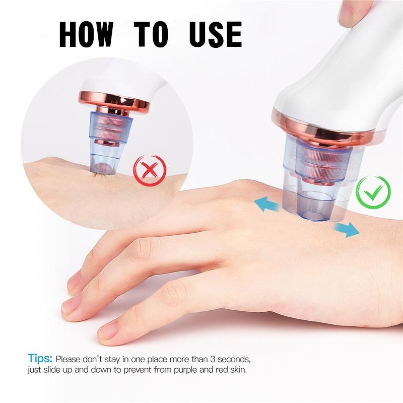 Вакуумный электрический пылесос для удаления черных точек, электрический нос, красота, лицо, глубокое очищение, уход за кожей, вакуумный пылесос для черных пятен, акне, очиститель пор, инструмент для прыщей