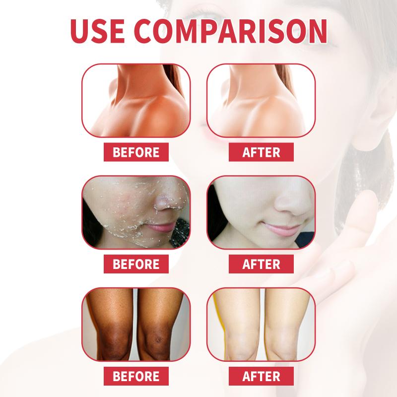 Отшелушивающий крем для лица с глубоким очищающим действием для чувствительной кожи – получите чистый и яркий цвет лица