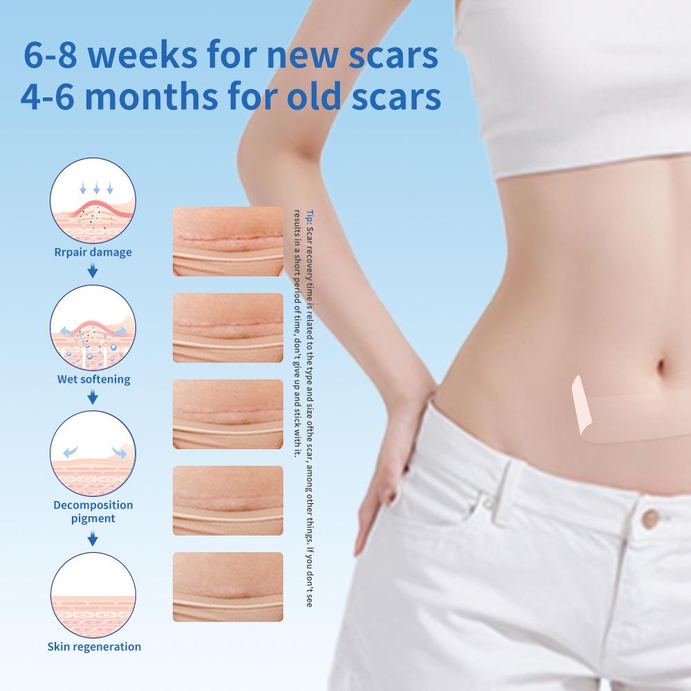 Невидимый пластырь для шрамов Прозрачный пластырь для шрамов Пластырь для удаления и заживления шрамов  (40мм х 1,5м)