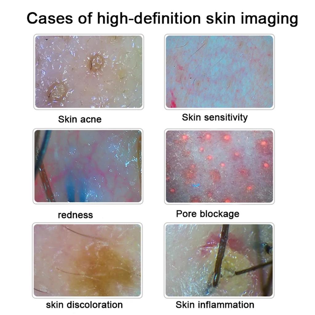 HD Digital Skin Analyzer Professional Hair Scalp Camera Detector Hair Follicle Oil Moisture Test Device 15inch