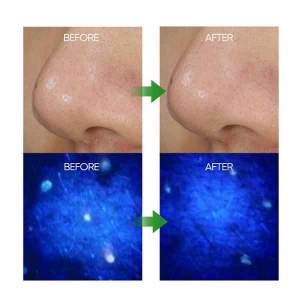 Очищающие средство для снятия макияжа. 100 мл