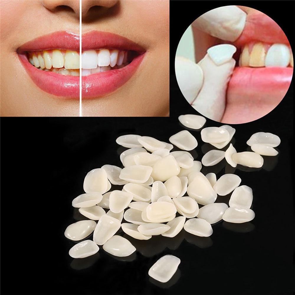 New 100Pcs Dental Temporary Crown Veneers for Anterior Front Teeth Whitening