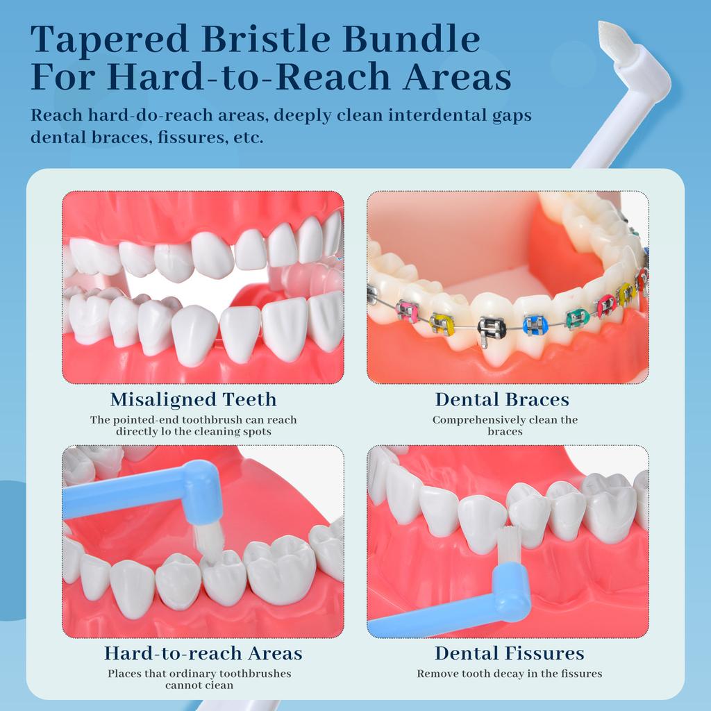 Premium Soft-Bristled Pointed-Tip Interdental Brush for Braces