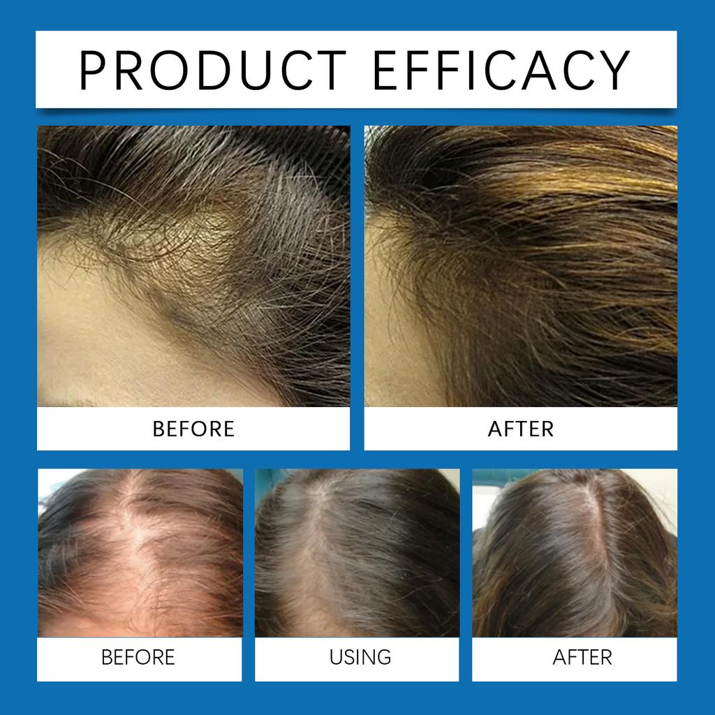 Жидкость для стимулирования роста волос активизирует волосяные фолликулы, уменьшает выпадение и ломкость волос, делает волосы черными и блестящими.10 мл