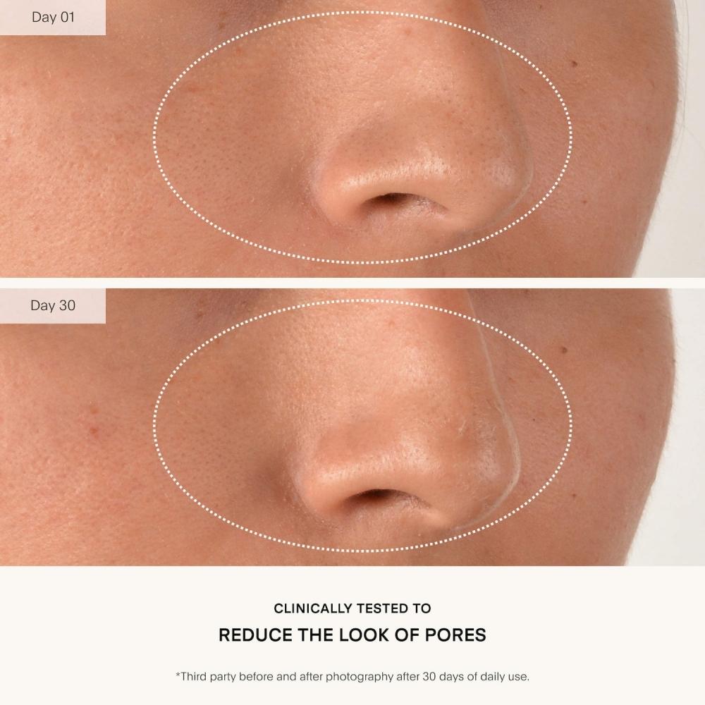 U beaUty resUrfaCing CompoUnd FaCe serUm With Retinol + Vitamin C 0.5 Oz 15 Ml 0.5 Oz 15 Ml