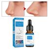 10ml Useful User Friendly Non-Irritating Nose Oil Narrow Essential for Unisex