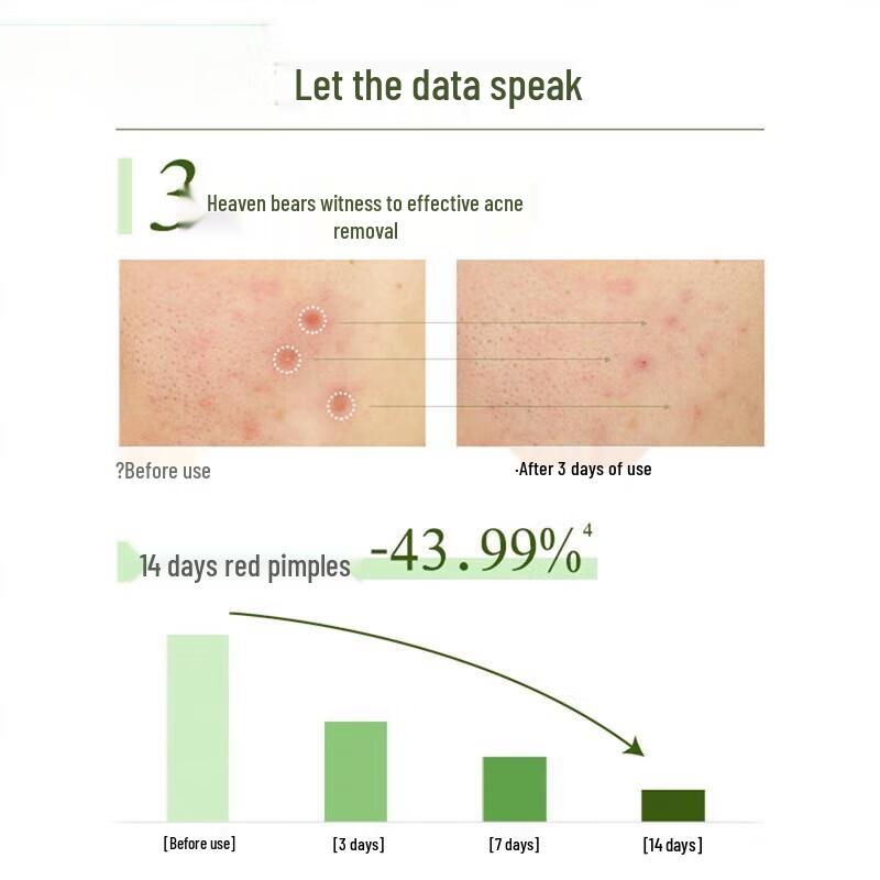 POND'S Очищающее средство для лица от акне