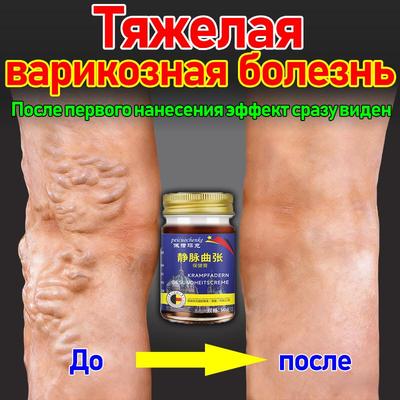 Патч от варикозного расширения вен, который улучшает кровообращение