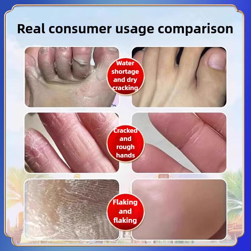 Strong Hand & Foot Fissure Balm - Deeply Nourishing, Soothes Pain