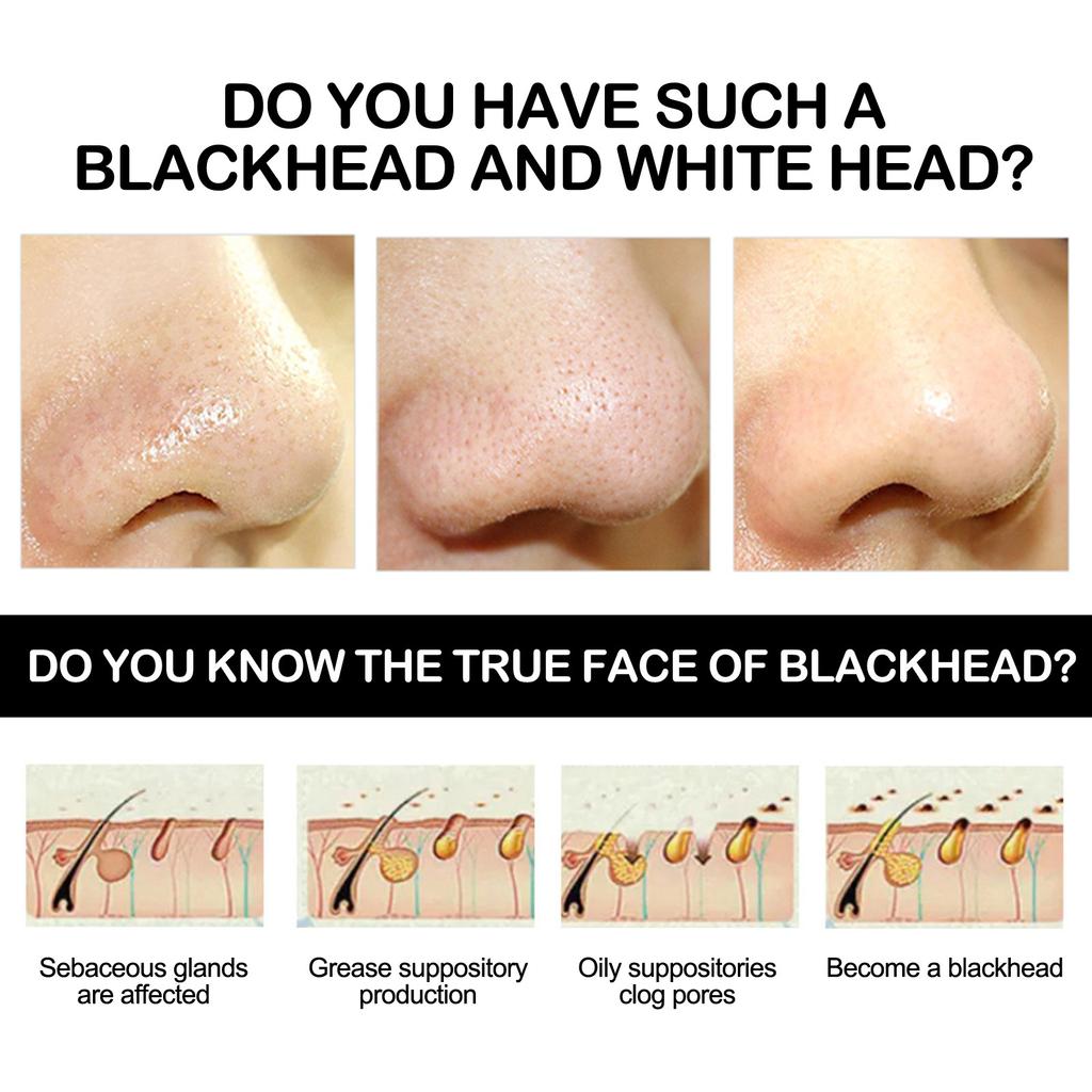 Отшелушивающая маска с бамбуковым углем и черными точками, сужающая поры, контроль жирности, увлажняющая и увлажняющая грязевая маска