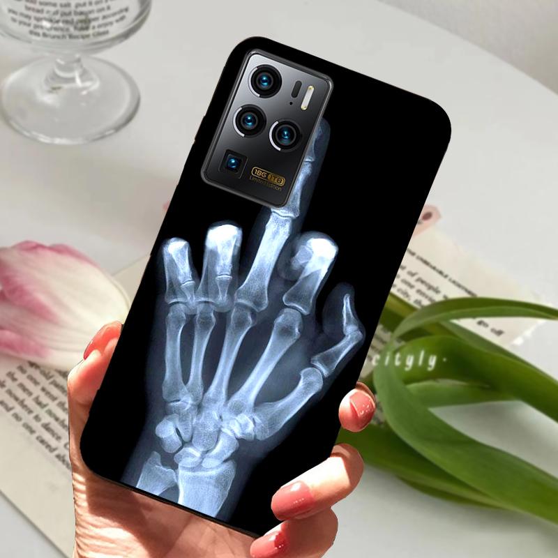 For ZTE Axon 30 Ultra Phone Case Axon30 Animals TPU Silicone Soft Funda Back Cover For ZTE Axon 30 Pro 30s Protector Cases Coque