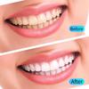10/20 шт. Набор геля для отбеливания зубов Уход за полостью рта Инструмент для отбеливания зубов Инструмент для отбеливания зубов с фильтрованным светом Удаление зубного налета и пятен