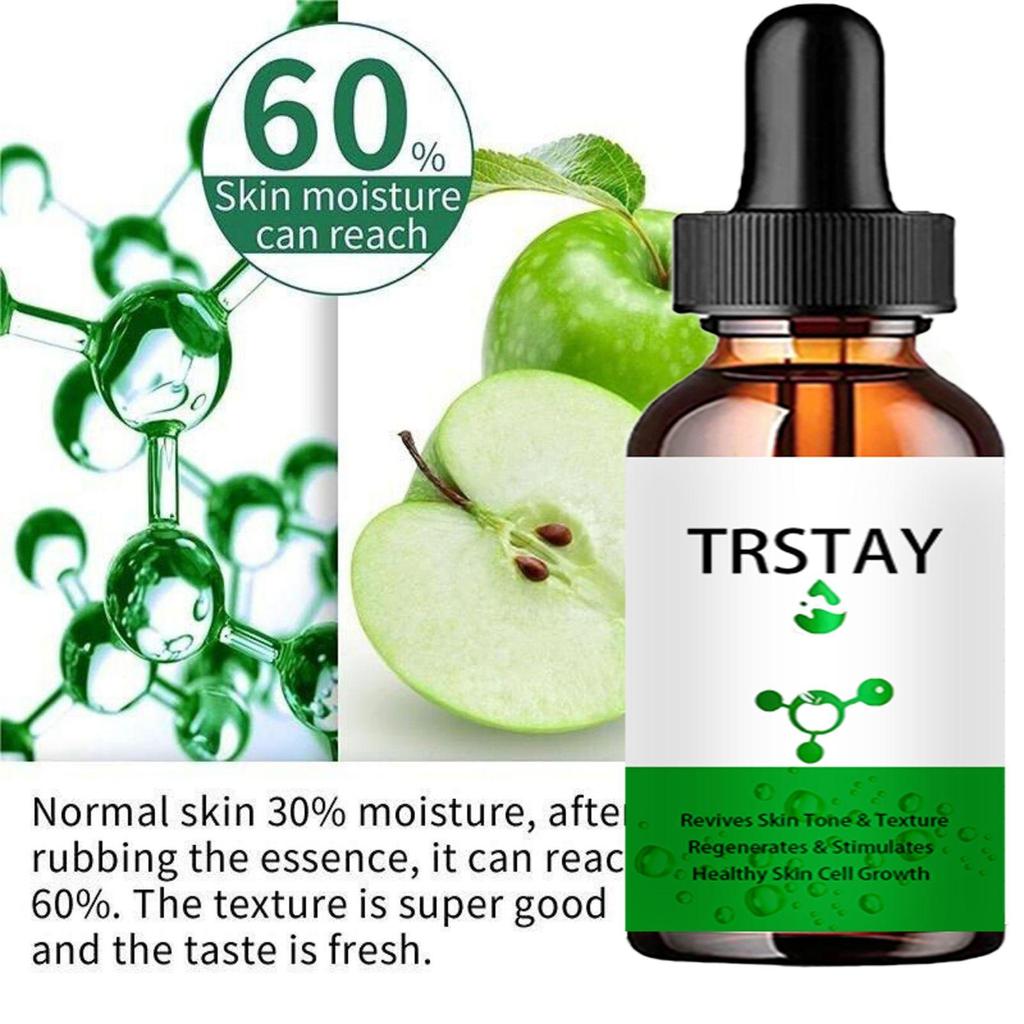 5ML/15ML/30ML/50ML/Anti Redness Solution ,Spider Vein Removal Advanced Treatment Clearer Skin Veins On Face