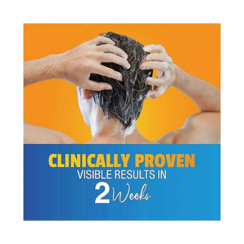 Anti-Dandruff Shampoo - Pink, 60ml, Soft Cleansing, for Men & Women, Fragranced 26s