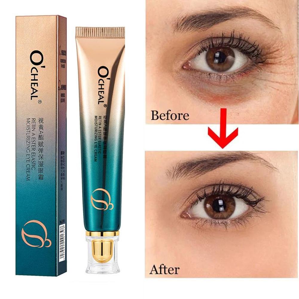 Крем для кожи вокруг глаз против морщин, осветляет мелкие морщинки, устраняет мешки под глазами, борется с темными кругами, омолаживающая сыворотка, укрепляет и осветляет кожу