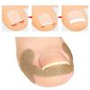 Ingrown Toenail Protection Sticker Toenail Care Toenail Care Pedicure Band