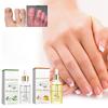 15ml Nail Strengthening Cuticle Oil, Nail Care Moisturizing And Brightening Nails, Care Oil