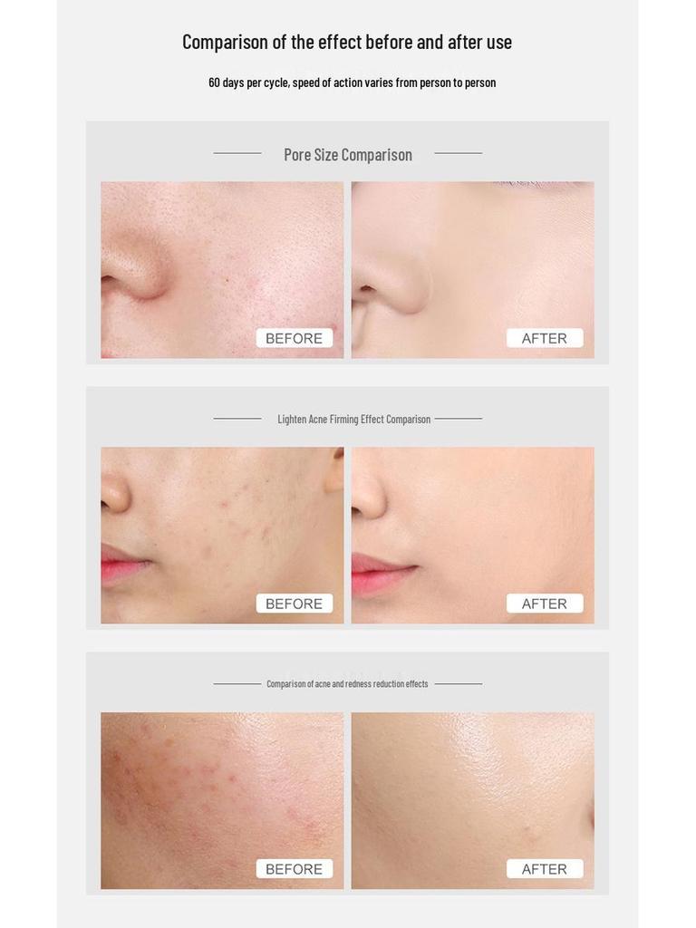 Foldable 7-Color LED Spray Spectrometer: Reduces Acne, Moisturizes, Whitens, and Tightens Pores