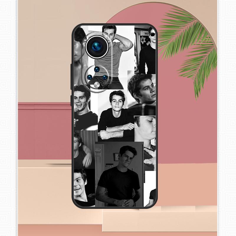 Dylan O'Brien Teen Wolf Case For Honor Magic 5 6 7 8 Pro Honor X9c X9b X9a X8b X8a X8c 50 70 90 400 200 Lite Cover