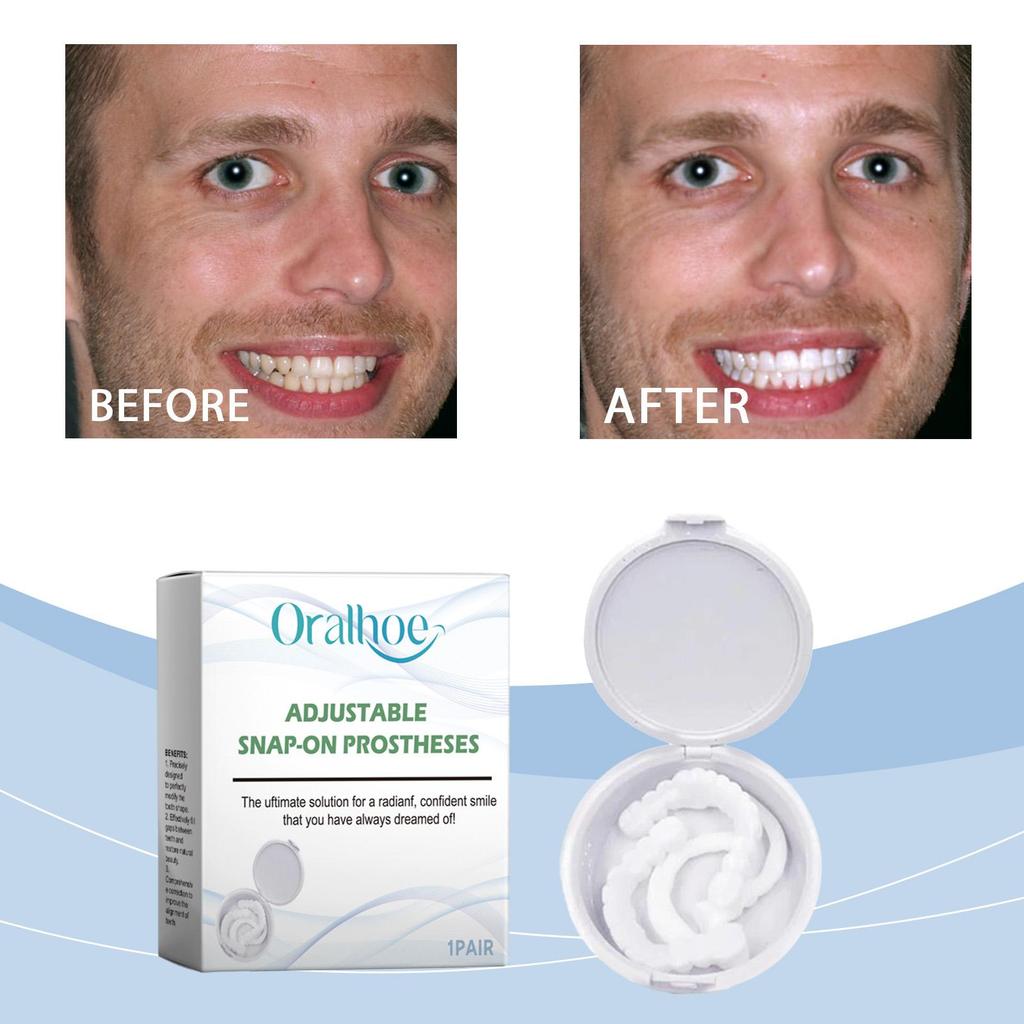 Взрослый регулируемый набор зубных протезов, зубы, накладные зубы, портативные брекеты, украшение для заполнения промежутков, улучшение эстетики улыбки, виниры, инструмент для красоты