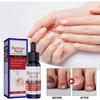 30ml Herbal Foot Spray, Foot Sweat, Foot Odor, Itching Relieving Spray, Odor Peeling Foot Care Spray