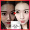 Newest Dark Spots Corrector Cream Whitening Facial Cream Repair Fade Freckles Remove Dark Spots Melanin Remover Brightening Face Cream