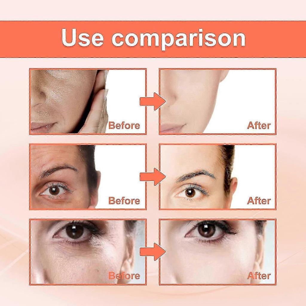 e Rose Oil Vc Anti Wrinkle Essence