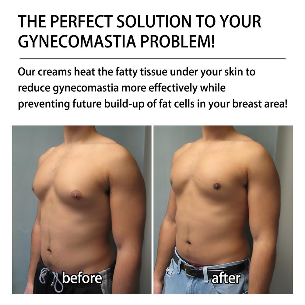 Крем для подтяжки кожи при гинекомастии с имбирем 30 мл Крем для уменьшения целлюлита при гинекомастии с имбирем укрепляющий