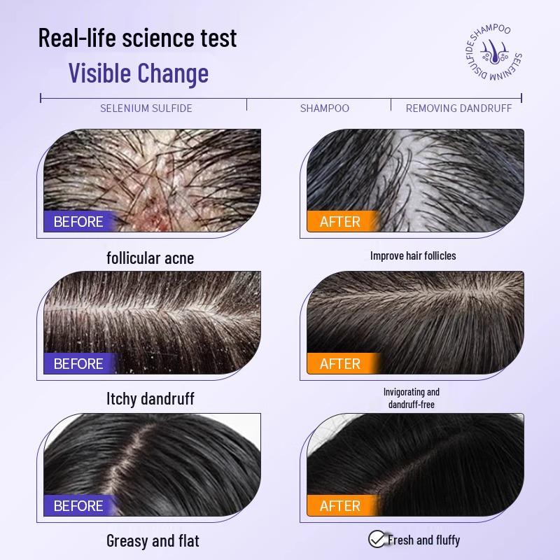 Шампунь против перхоти с сульфидом селена: Контроль жирности, Против зуда, Глубокое очищение, Стойкий аромат для мужчин и женщин.