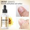 Herbal Nail Treatment Essential Oil Hand and Foot Whitening Toe Nail Removal Feet Care Polish Nail Gel Nail Repair Treatment