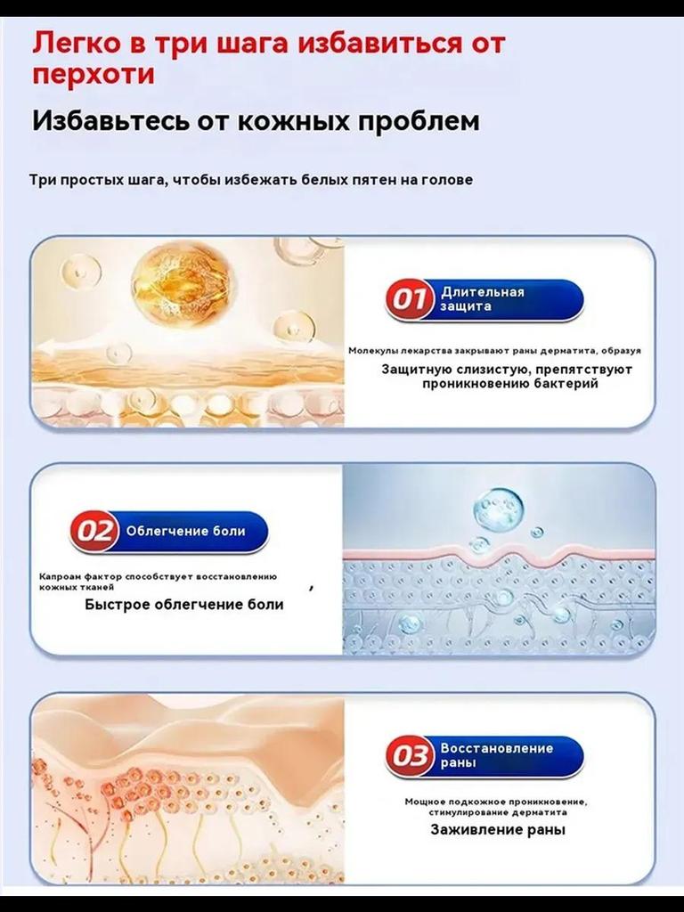 Ringworm Capitis and Scalp Special Spray Fungal Infection Dandruff Itching