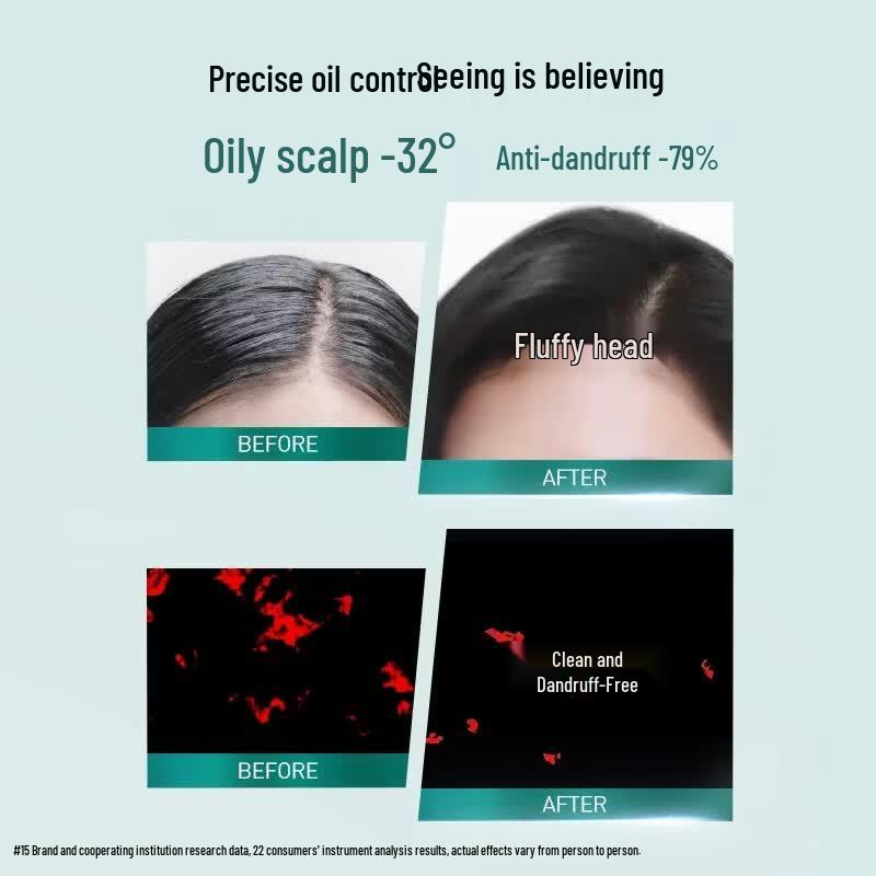 Набор шампуня и кондиционера L'Oréal для контроля жирности и очищения с салициловой кислотой