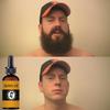 Beard Oil for Men Hair Growth Hair Tool Hair Laser Growth Alopecia Hair Treatment for Women