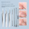 Yousheng Blackhead Remover Tweezers Set Stainless Steel Acne Clip Kit with Anti-slip Handle Pimple Popper Tool Easy To Carry Blackhead Extractor Skin