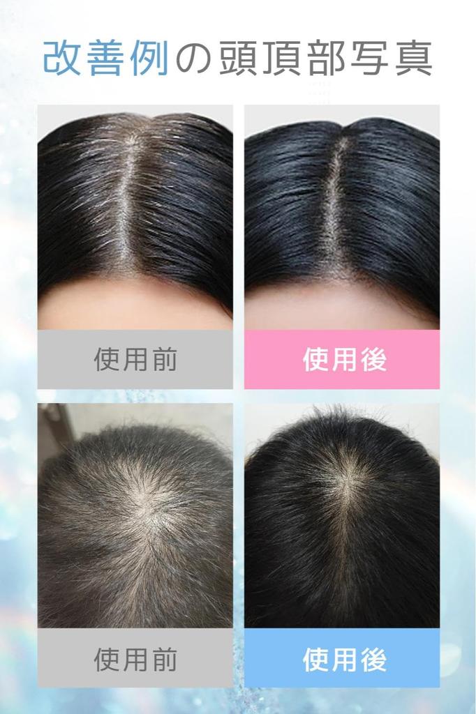 Электрический скальп Электрический косметический уход за кожей лица EMS скальп Множественный RF микро светодиодный свет Оптический уход за кожей лица и головы Большая емкость Жидкий Введение Расческа Дневной унисекс