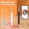 Wireless WiFi Ear Wax Removal Camera Ear Cleaner Kit Rechargeable Otoscope Earwax Removal Tool for Adult Kid Food Grade Silicone Tip Ear Pick Cleaning