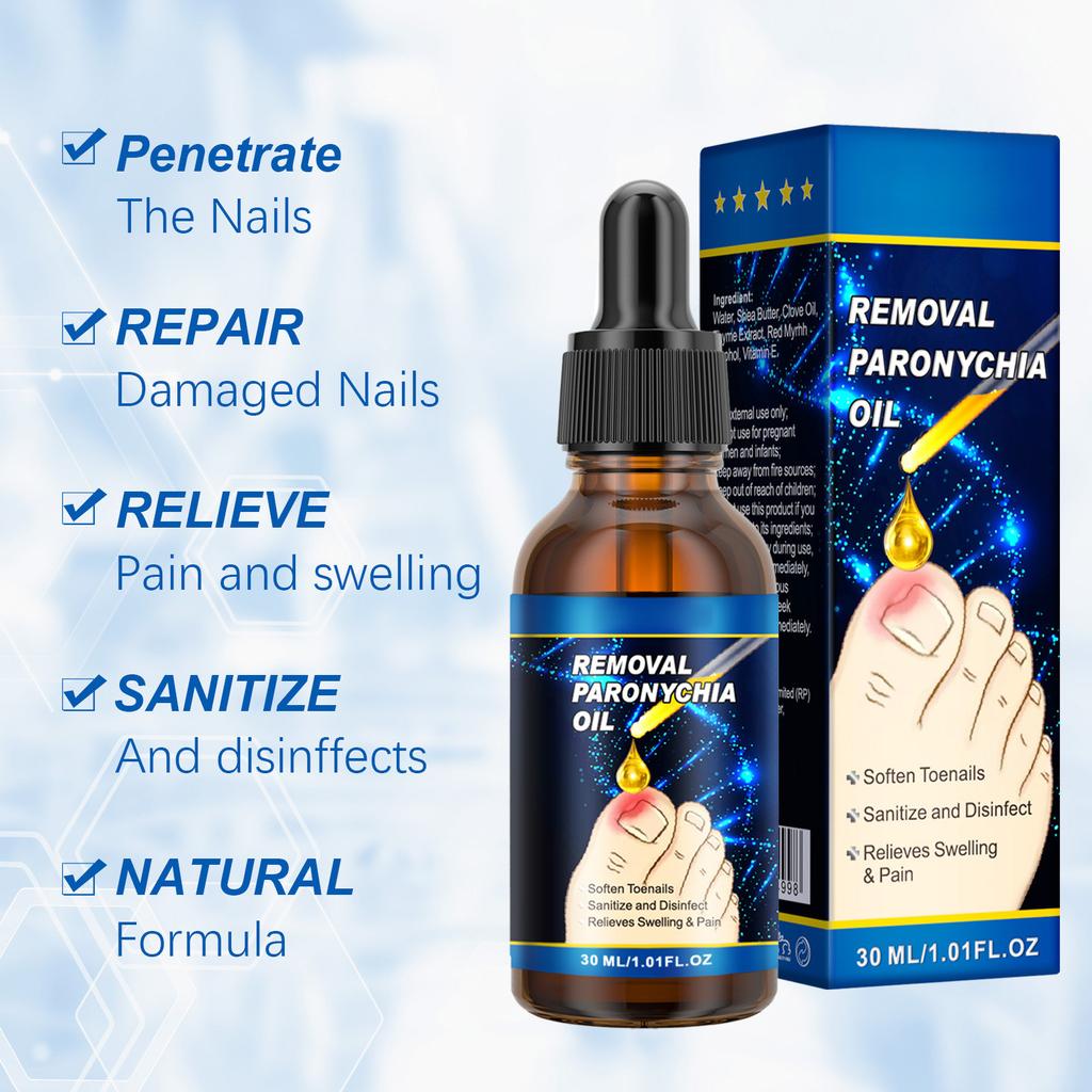 Масло для ногтей от бороздок 30 мл. Масло для ногтей от вросших ногтей, воспаление, поддержание здоровья ногтей, смягчение масла для ногтей от бороздок