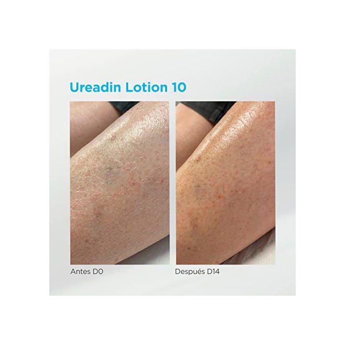 Lotion de Massage - ISDIN - UREADIN - Hydratant - Sans Odeur - Peau Grasse