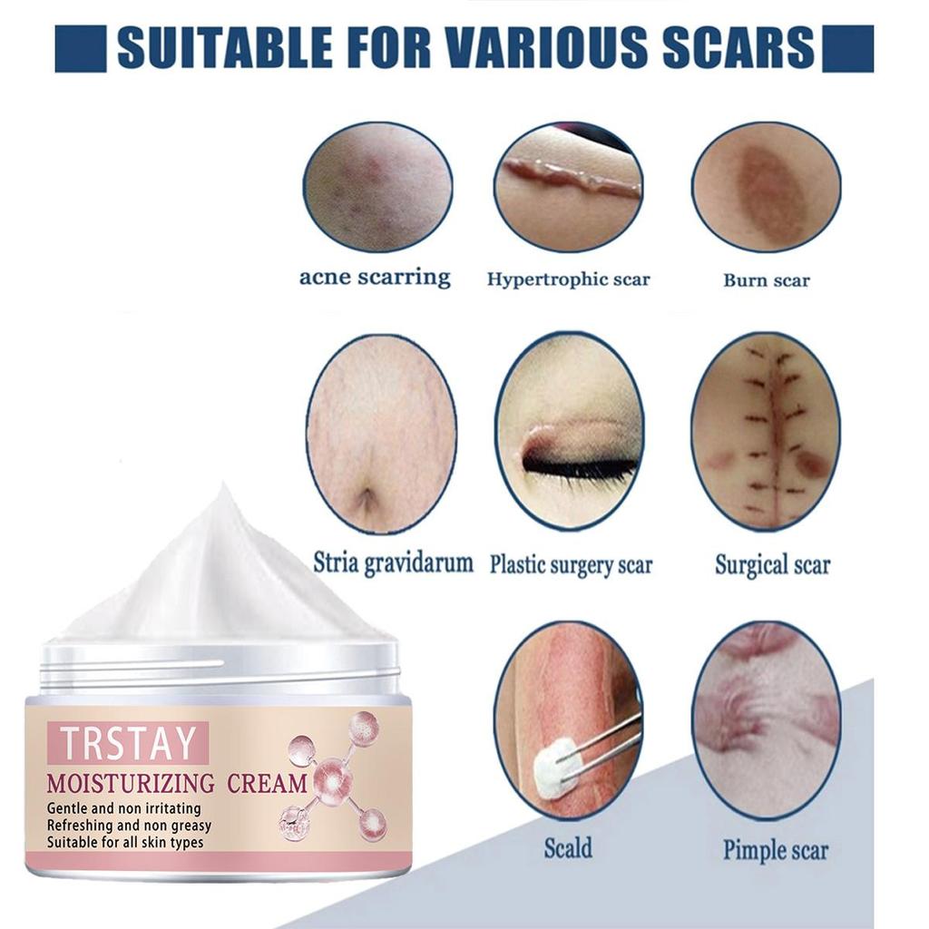 Сыворотка для удаления шрамов от прыщей, масло, эфирные масла, эссенция, гель, лечение растяжек, прыщи, пятна от прыщей, хирургические шрамы, ожоги