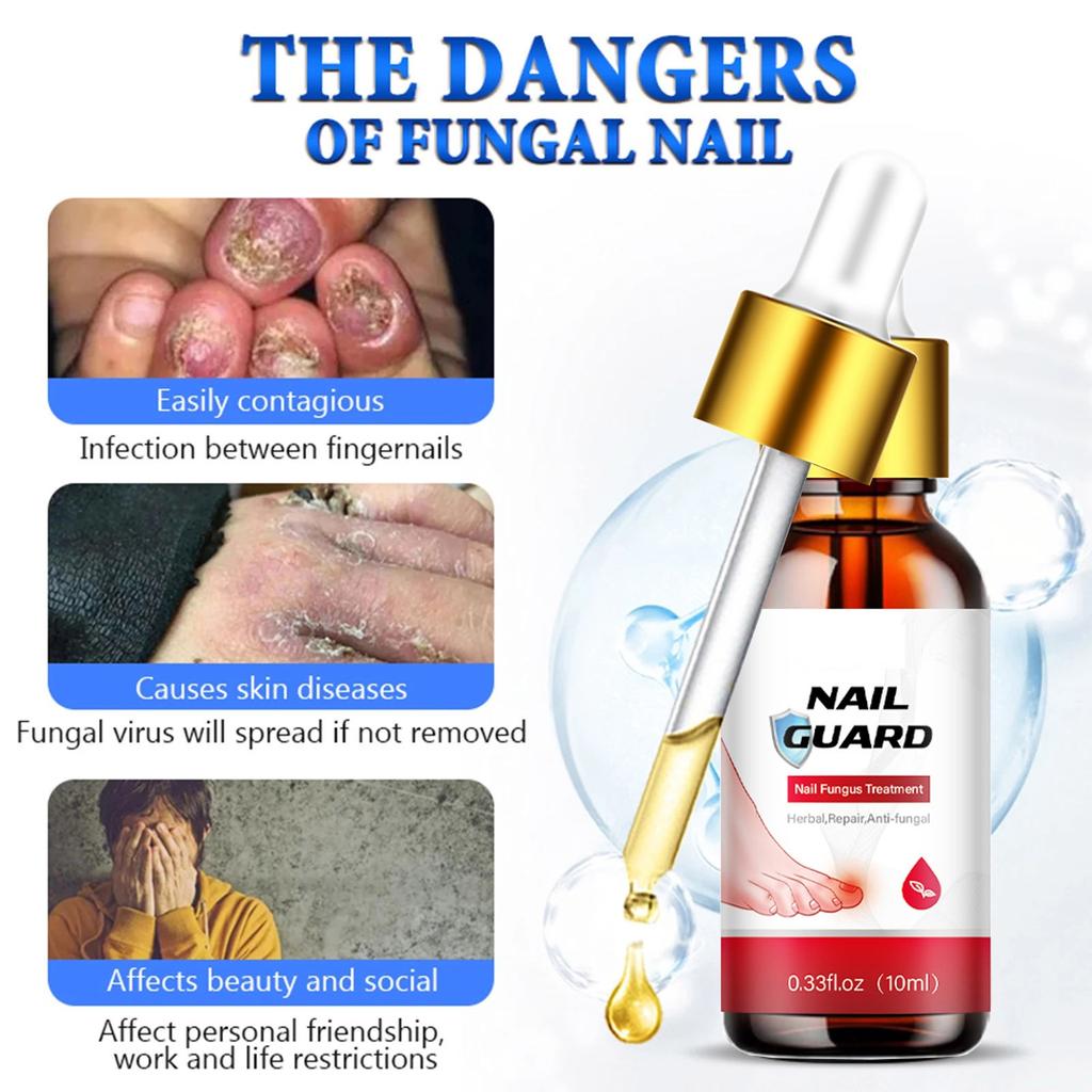 Toenail Fungal Super Strong Nail Care Nail Care Super Strong For Thick Discolored And Damaged Nails10ml