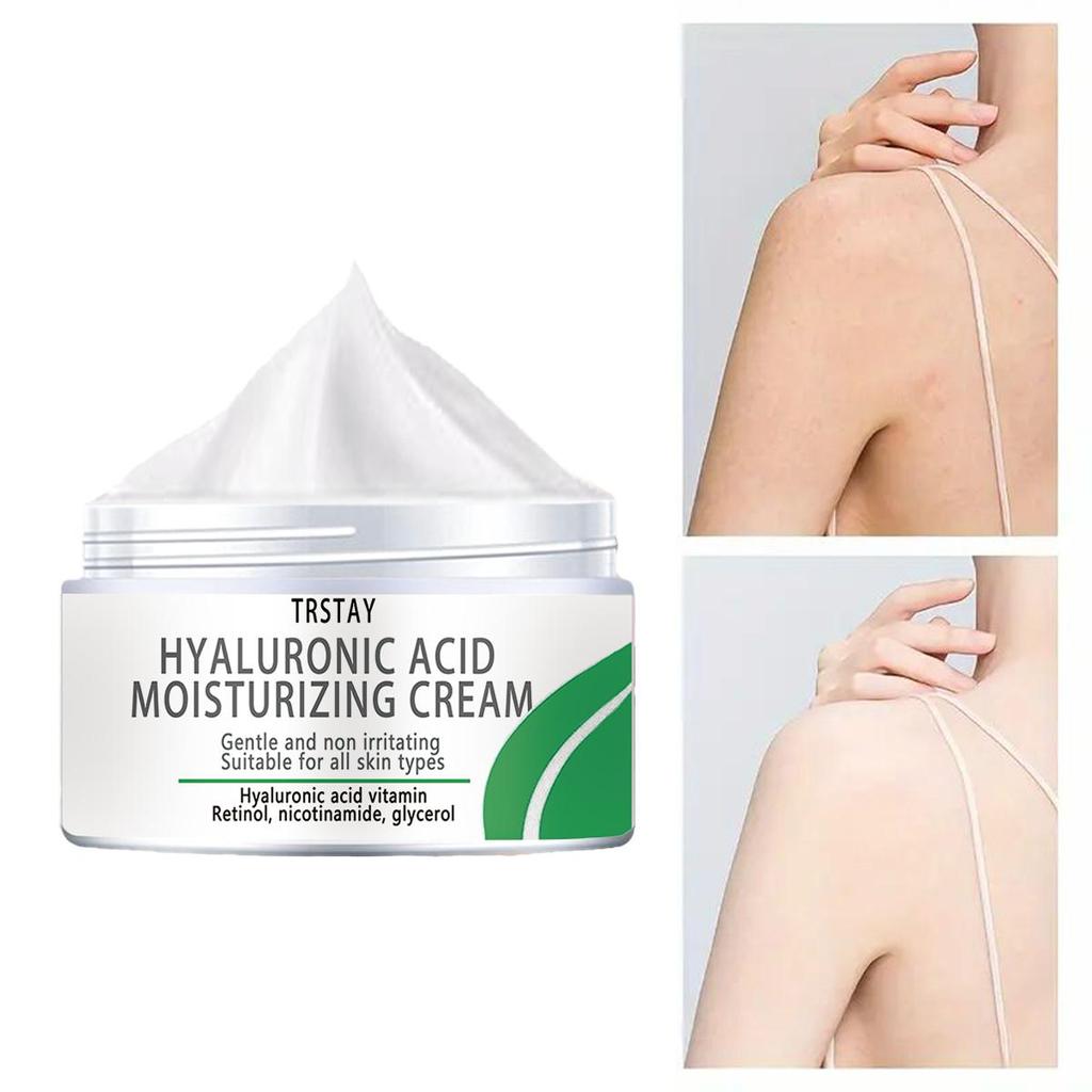 Отбеливающий крем для кожи, контролирующий жирность кожи, маскирующий поры, отбеливающий кожу от прыщей